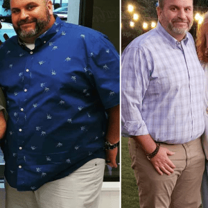 Richie MIlls Before and After SkinnyBox